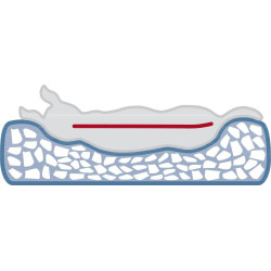 Ortopedický pelech BENDSON Vital, obdélníkový s okrajem, tmavě šedá/světle šedá